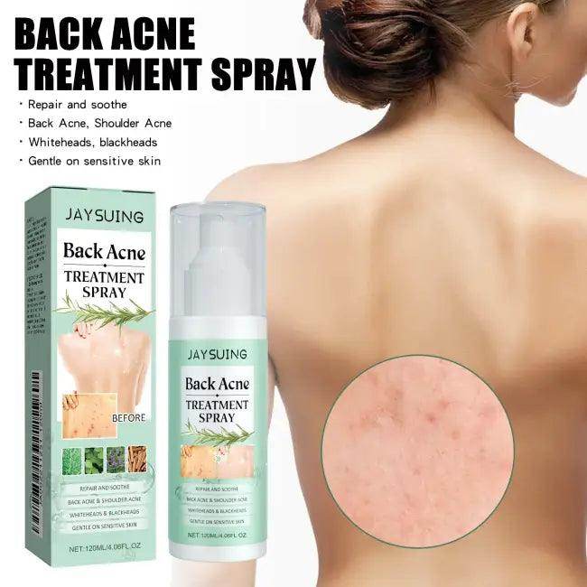 Revolutionary Acne Treatment Spray to Blast Away Back Acne - Estalios