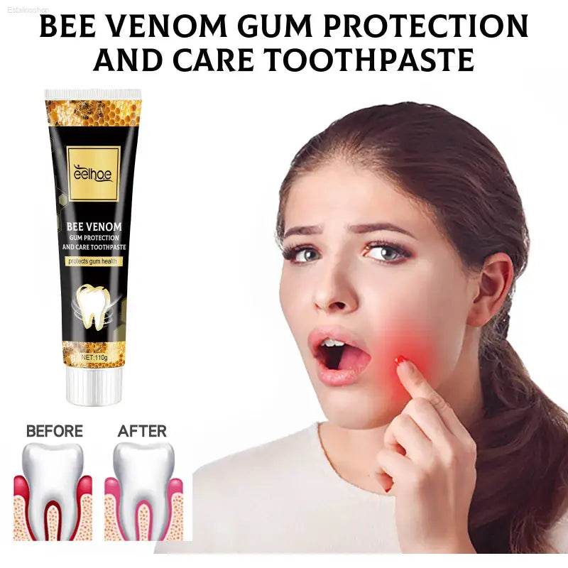 Bee Venom Gingival Toothpaste for Whitening and Fresh Breath - Estalios