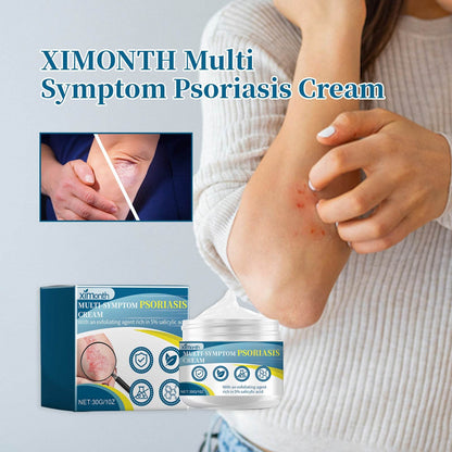 Ximonth Psoriasis Treatment Cream for Redness and Itch Relief - Estalios