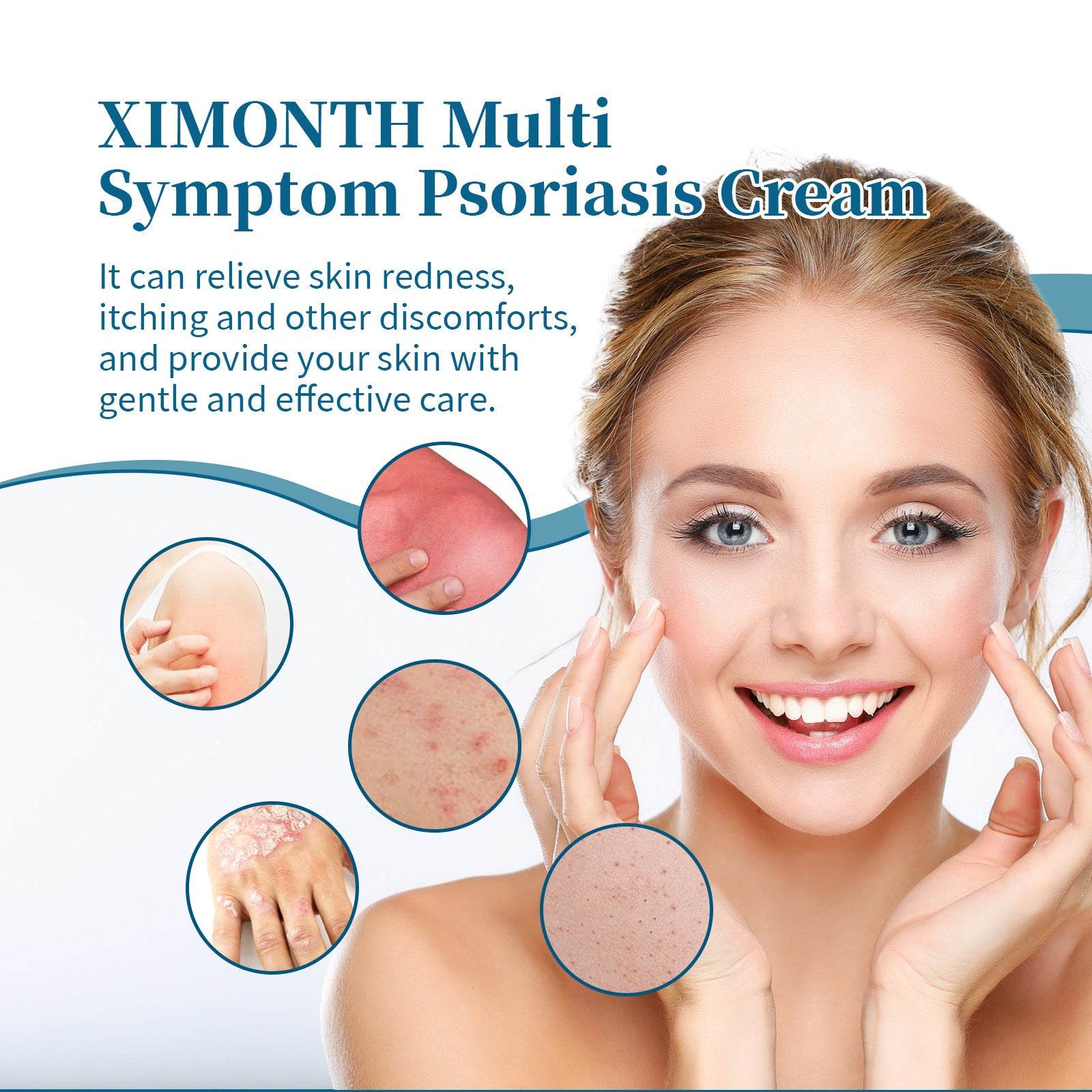 Ximonth Psoriasis Treatment Cream for Redness and Itch Relief - Estalios
