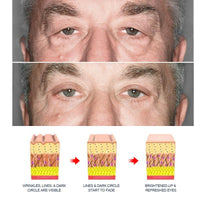 Goodbye Tired Eyes: Blue Rescue! - Estalios