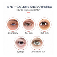 Goodbye Tired Eyes: Blue Rescue! - Estalios