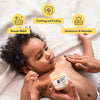 Eczema Honey Survival Kit - Estalios