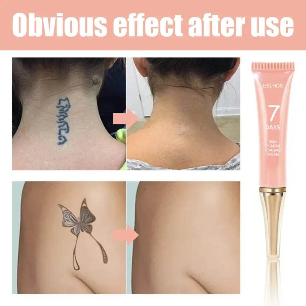 EELHOE Print Remover for Effortless Tattoo Fading Cream - Estalios