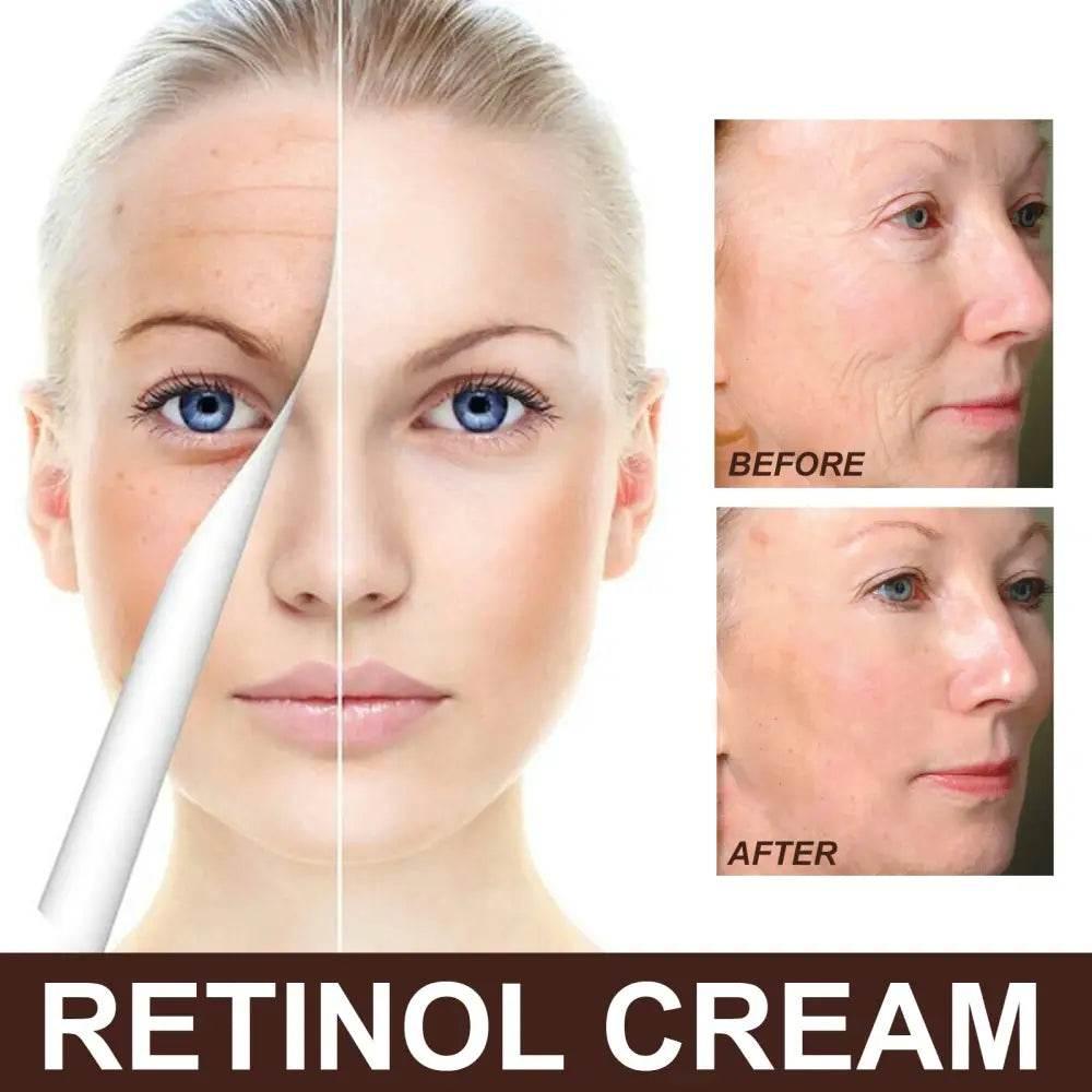 EELHOE Retinol Cream for Anti-Aging and Hydration - Estalios