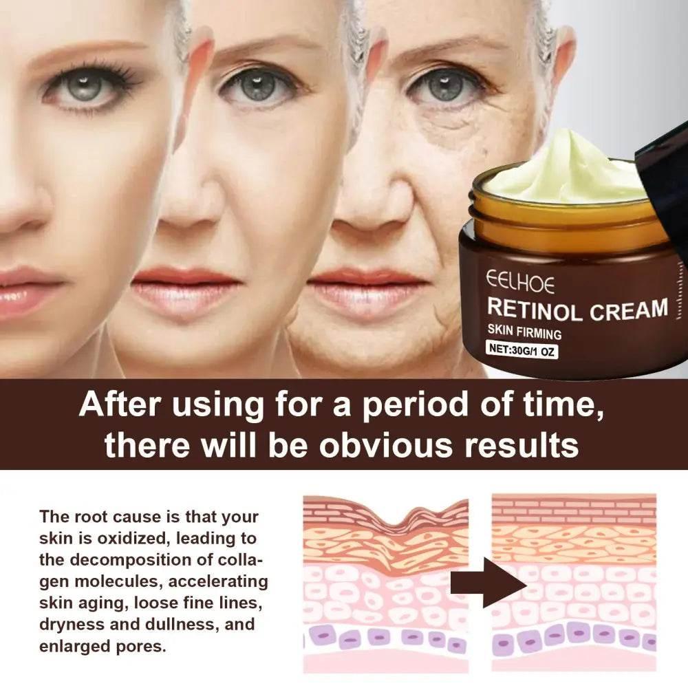 EELHOE Retinol Cream for Anti-Aging and Hydration - Estalios