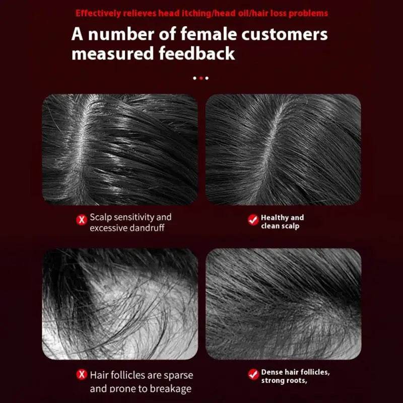 Electric Vibration Massage Comb for Hair Growth and Scalp Care - Estalios
