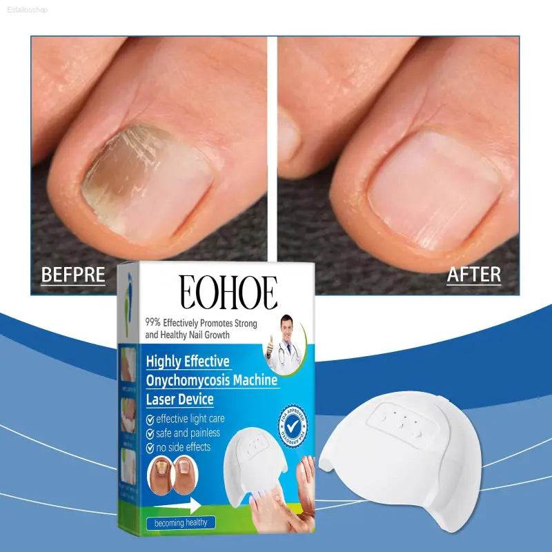Eohoe Nail Care Instrument for Gentle Nail Repair and Care - Estalios