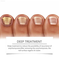 Eohoe Nail Care Instrument for Gentle Nail Repair and Care - Estalios