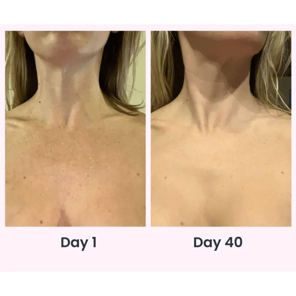 Face Massager Anti Wrinkles for Youthful Radiance - Estalios