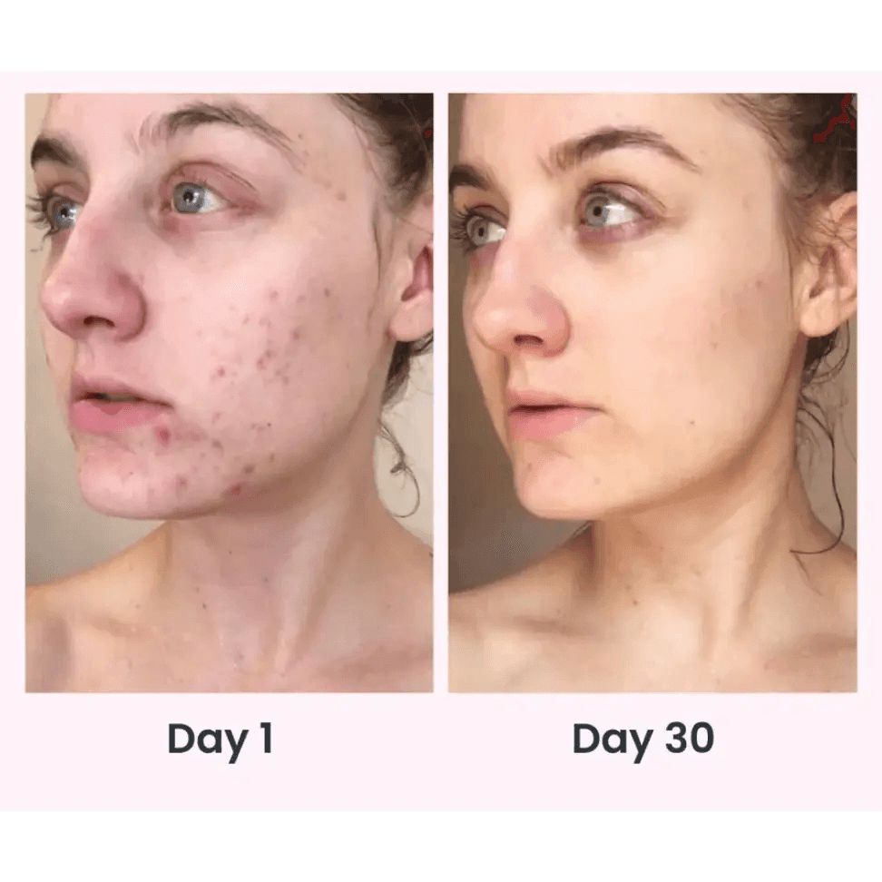 Face Massager Anti Wrinkles for Youthful Radiance - Estalios