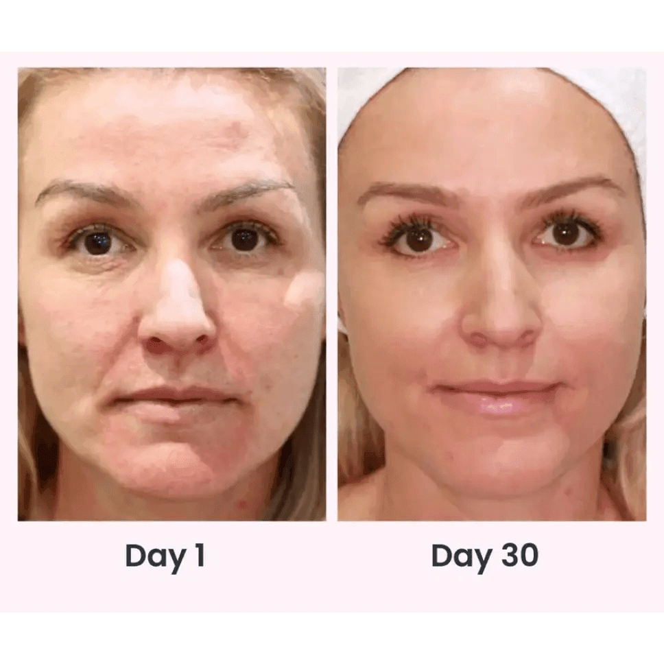 Face Massager Anti Wrinkles for Youthful Radiance - Estalios