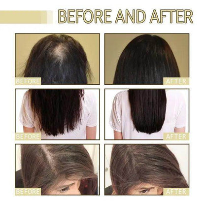 Hair Boost Oil for Dense Hair Growth and Nourishment - Estalios
