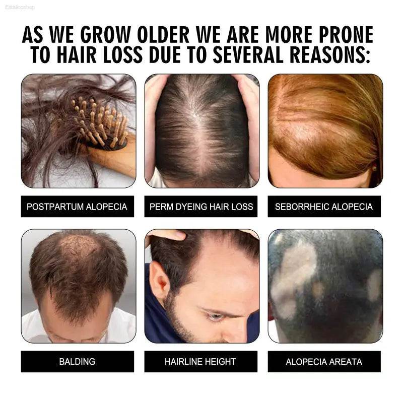Hair Conditioning Essence for Dull Hair and Scalp Repair - Estalios