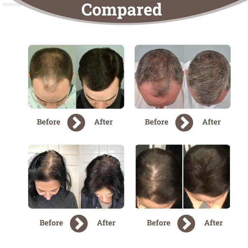 Hair Enhancement Spray Anti-Loss Treatment for Strong Hair - Estalios