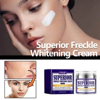 Glow Up with Our Superior Freckle Whitening Cream - Estalios