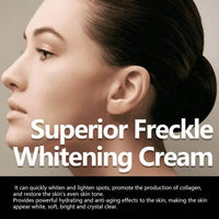 Glow Up with Our Superior Freckle Whitening Cream - Estalios