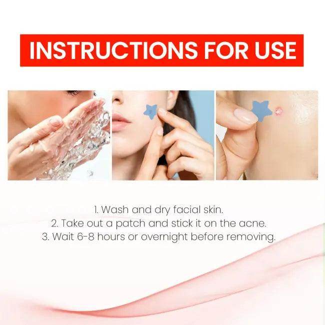 Jaysuing Pimple Patch - Fast Star-Shaped Blemish Relief - Estalios