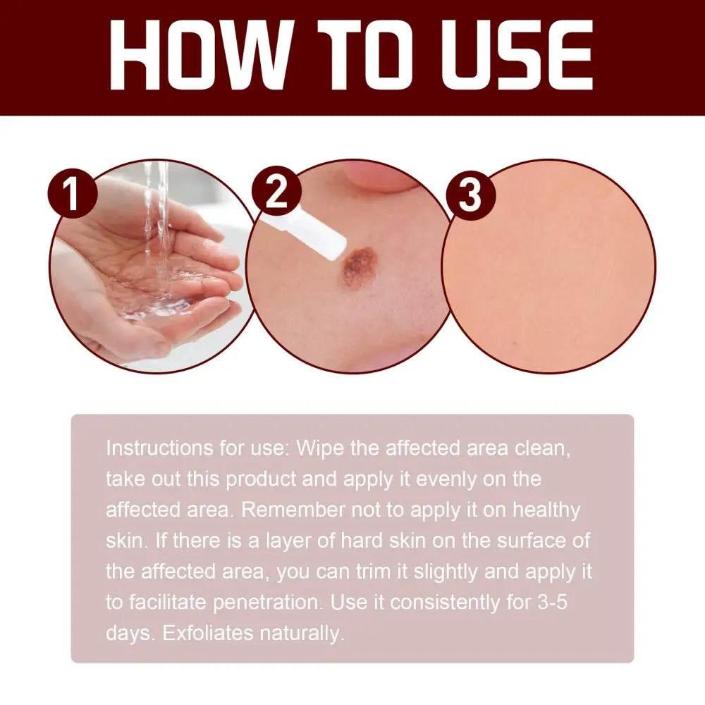 Jaysuing Wart Cream Pen for Fast Skin Repair - Estalios