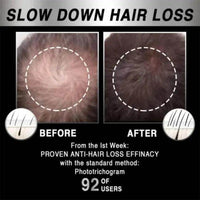 Amp Up Your Hair Game with Innovative Laser Growth Cap - Estalios