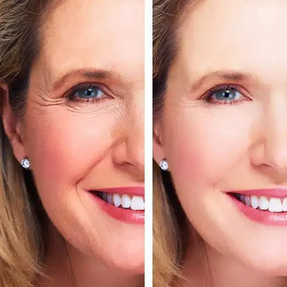 Before-and-after skincare results using LeVea Night Repair Anti-Aging Treatment