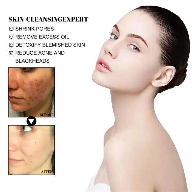 Radiant Skin Transformation With Green Clay Mask Magic - Estalios