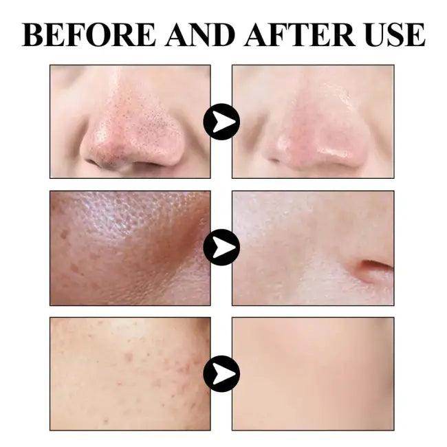Radiant Skin Transformation With Green Clay Mask Magic - Estalios