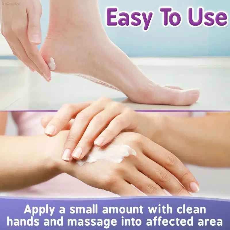 Next Gen U Cracked Hands & Heel Repair Cream - 8.5oz Ultra Moisturizing Formula for Extremely Dry and Sore Skin - Estalios