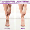 Next Gen U Cracked Hands & Heel Repair Cream - 8.5oz Ultra Moisturizing Formula for Extremely Dry and Sore Skin - Estalios