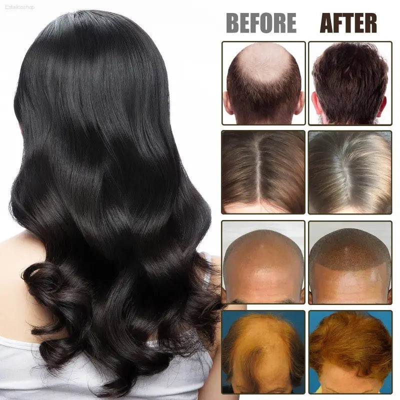 NMN Scalp Cell Revitalizing Hair Essence, Hair Care Strengthen And Strengthen Hair Repair Hair Root Thickening Hair Moisturizing Essence - Estalios