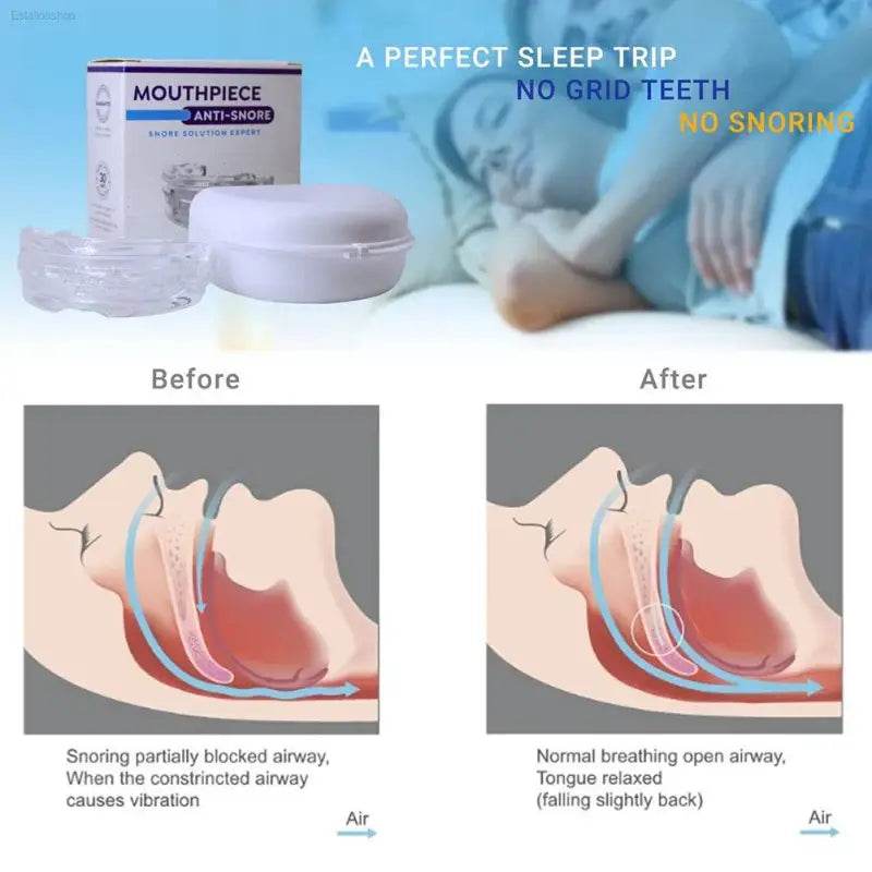 Portable Anti Snoring Devices with Storage Box for Sleep Quality - Estalios