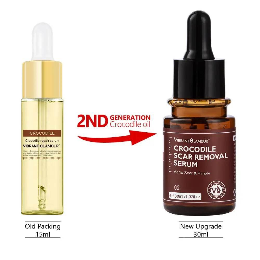 Promotion Face Spot Remover for Healing Acne Scars - Estalios