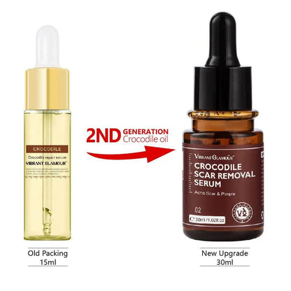 Promotion Face Spot Remover for Healing Acne Scars - Estalios