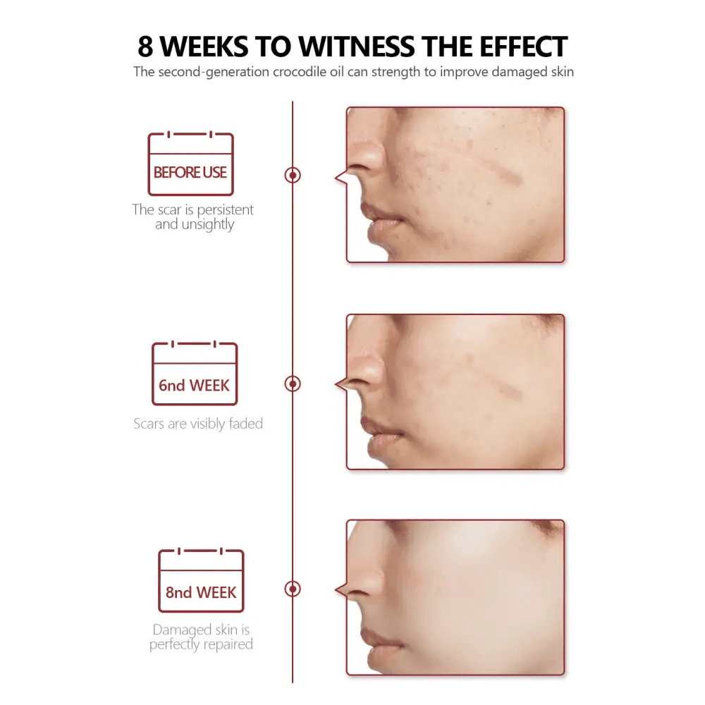 Promotion Face Spot Remover for Healing Acne Scars - Estalios
