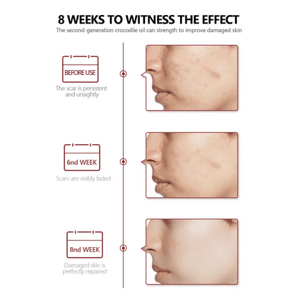 Promotion Face Spot Remover for Healing Acne Scars - Estalios