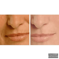 Revitalize Your Skin with Le’vea Anti-Aging Set Today - Estalios