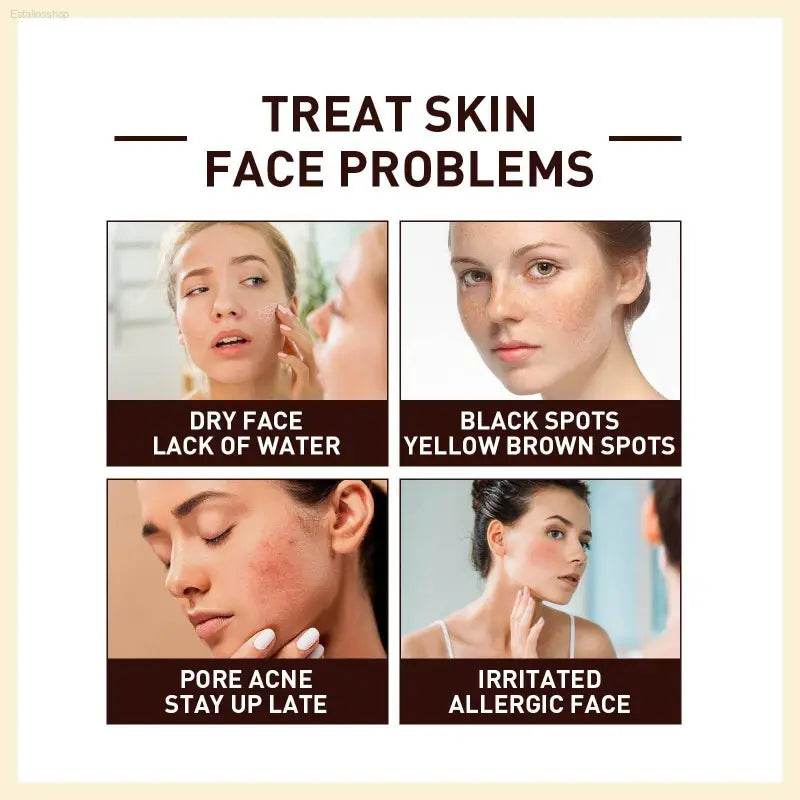 Rice Anti Wrinkle Essence, Repairs, Moisturizes, Firms - Estalios