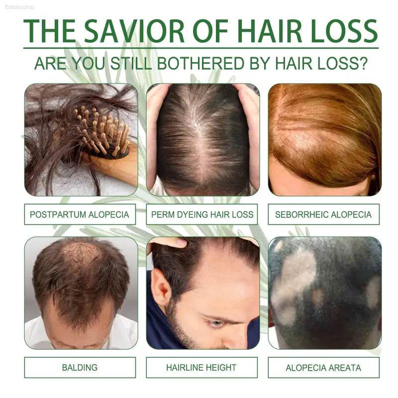 Rosemary Hair Dense Essential Oil for Stronger Hair Growth - Estalios