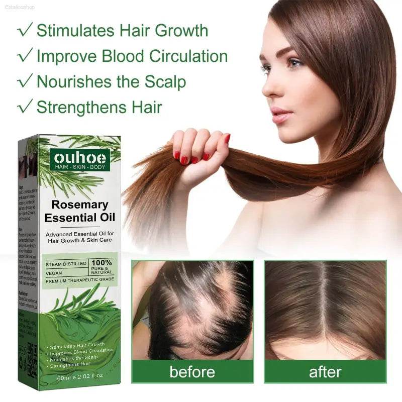 Rosemary Hair Dense Essential Oil for Stronger Hair Growth - Estalios