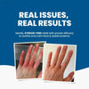 Soothing Eczema Relief Pack - Estalios