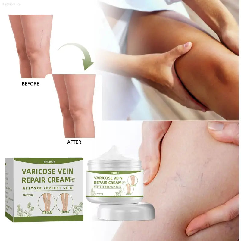 🌿 Soothing Relief – Leg Repair Cream for Varicose Veins | Nourish and Revitalize Tired Legs - default title