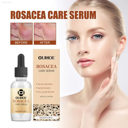 ✨ Soothing Repair – Erythematous Repair Essence | Hydrating and Strengthening Serum for Sensitive Skin - default title