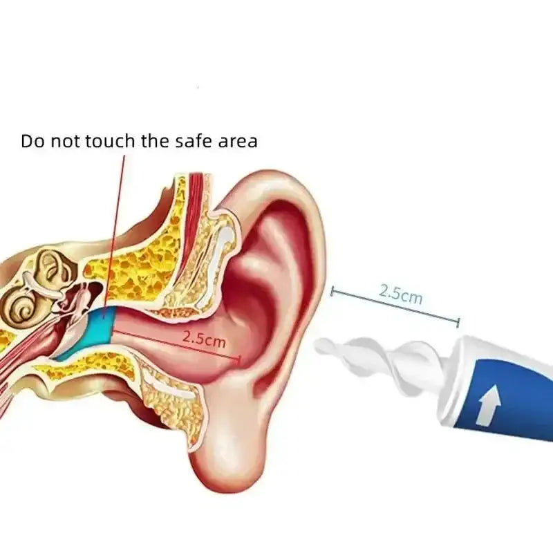 Spiral Ear Wax Remover Tool with diagram for safe ear cleaning and wax removal