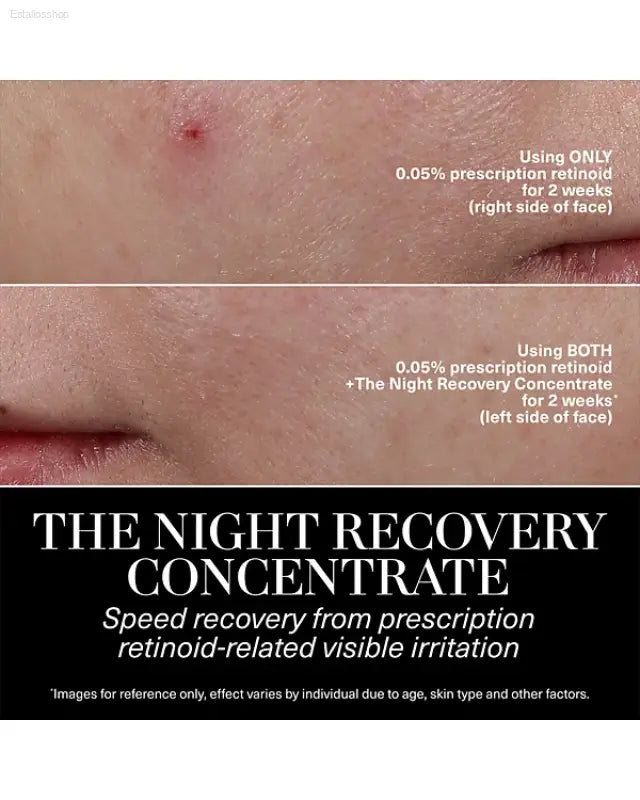 ✨ Ultimate Recovery – La Mer Night Recovery Concentrate Treatment | Ideal for Sensitive Skin and Post-Treatment Care