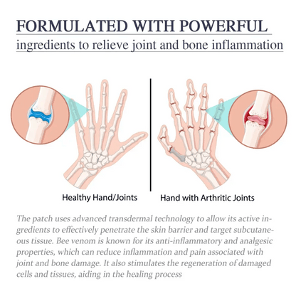 Ximonth Bee Venom Joint Cream for Effective Pain Relief - Estalios