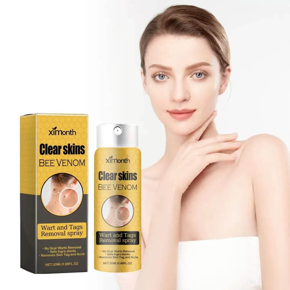 Ximonth Wart And Tags Removal Spray for Smooth Skin - Estalios