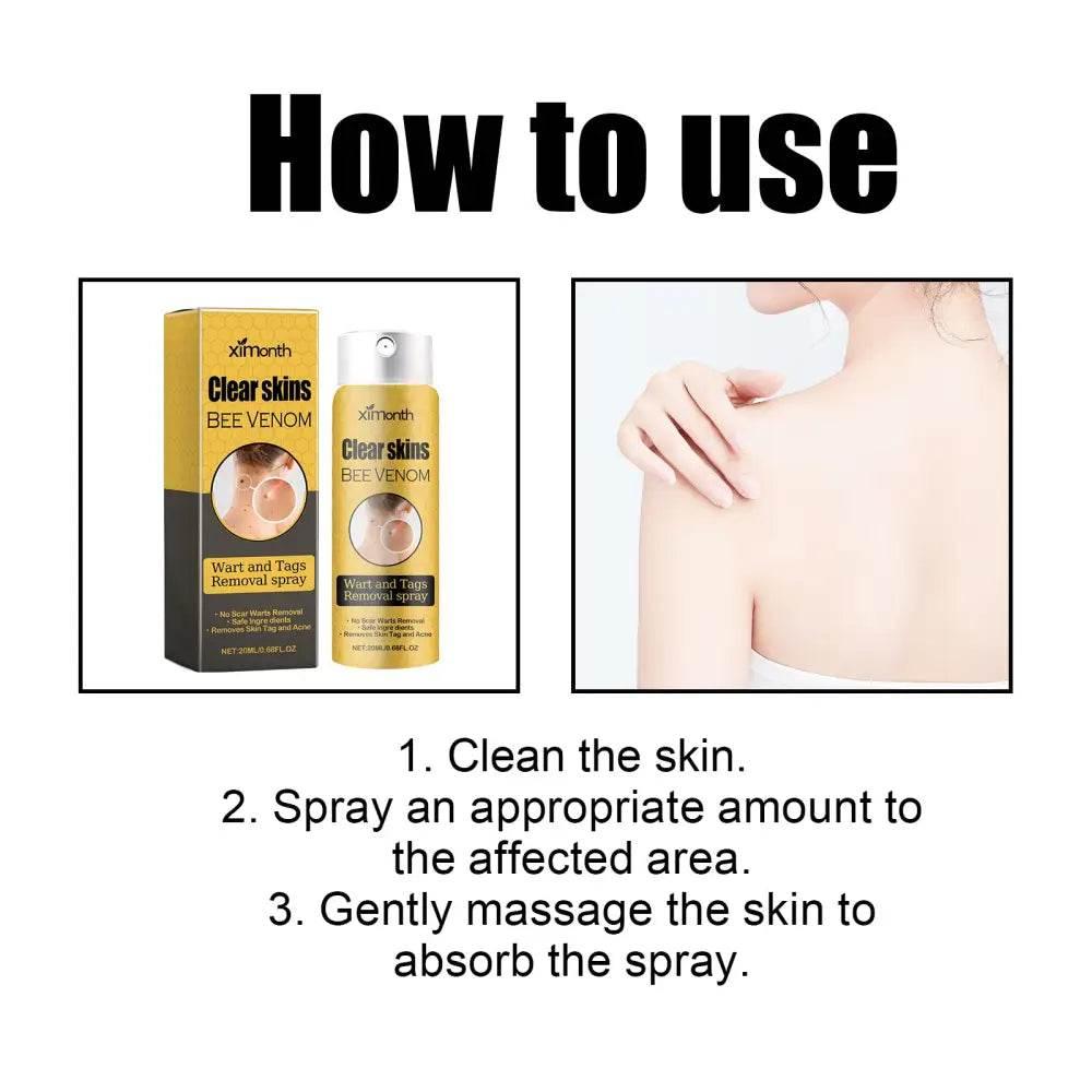 Ximonth Wart And Tags Removal Spray for Smooth Skin - Estalios