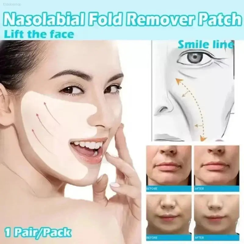 Youthful Glue-Free Lift Patches – Say Goodbye to Fine Lines! Wind Beauty Store  EstaliosShop