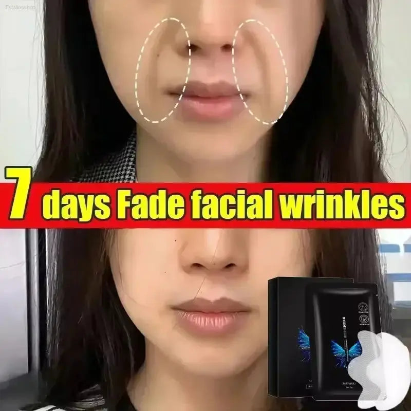 Youthful Glue-Free Lift Patches – Say Goodbye to Fine Lines! Wind Beauty Store  EstaliosShop